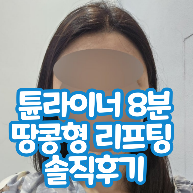  강남역 튠라이너 후기 피부과 광대 윤곽주사 땅콩형 솔직후기 8분 (ㅇㅍㅊㅇㅇ)
