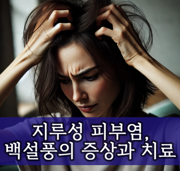 지루성 피부염, 백설풍의 증상과 관리 방법, 치료사례