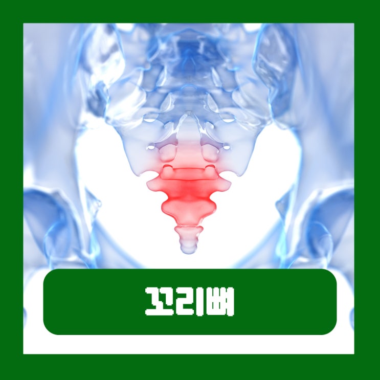  꼬리뼈 골절 원인 실금 위치 타박상 통증 치료