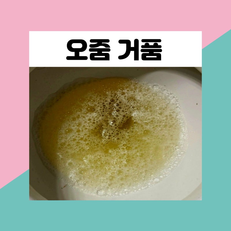 오줌에 거품 단백뇨 원인 남자 여자 소변에 거품 아침 소변 거품 이유 알아보자