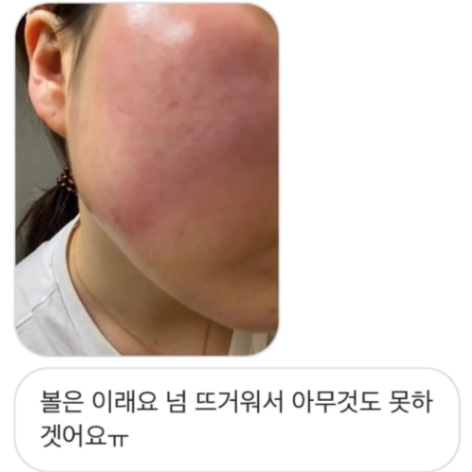  약물로 인한 피부병-약진,중약독의 증상과 치료 사례