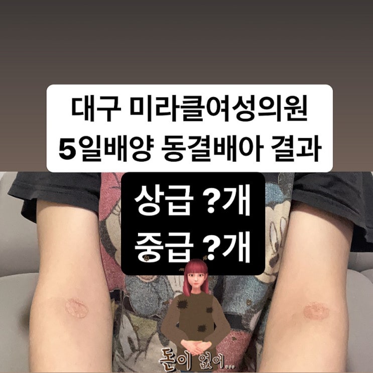  대구 미라클여성의원 두번째 5일배양 동결배아 상급배아 갯수