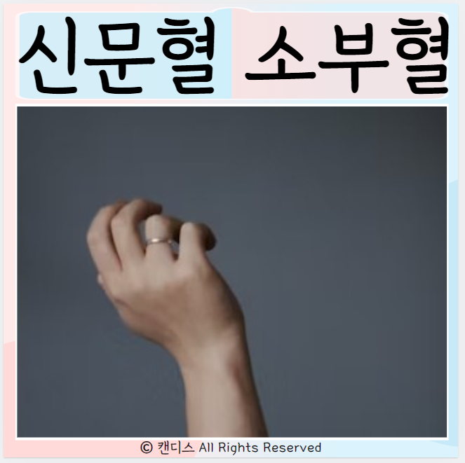  신문혈 자극법은? 효능 소부혈 합곡혈 전충혈 알아보기