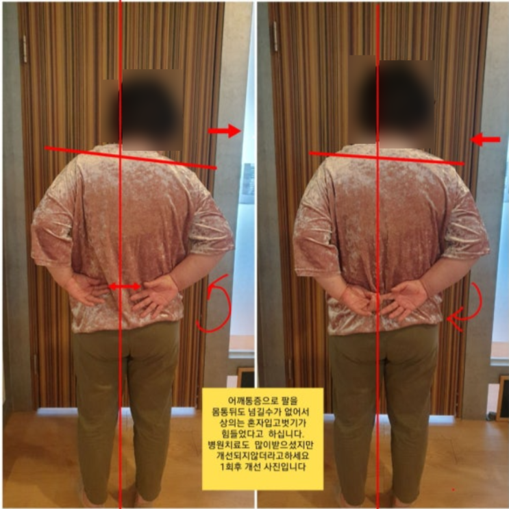  부산 동래 어깨통증 치료 LV체형분석운동센터 레슨 1회 후기