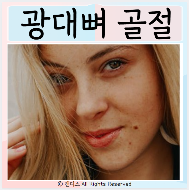  광대뼈 골절 원인 주의사항 진단과 치료