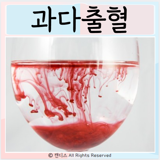  과다출혈 원인 방지와 치료 혈우병