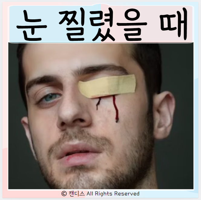  눈 찔렸을 때 응급실 대처방법
