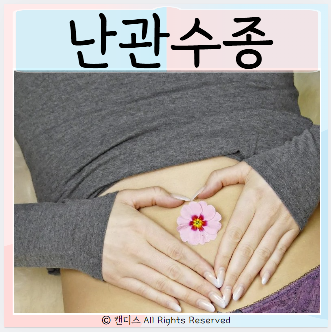  나팔관 난관수종 원인 증상 통증 치료방법