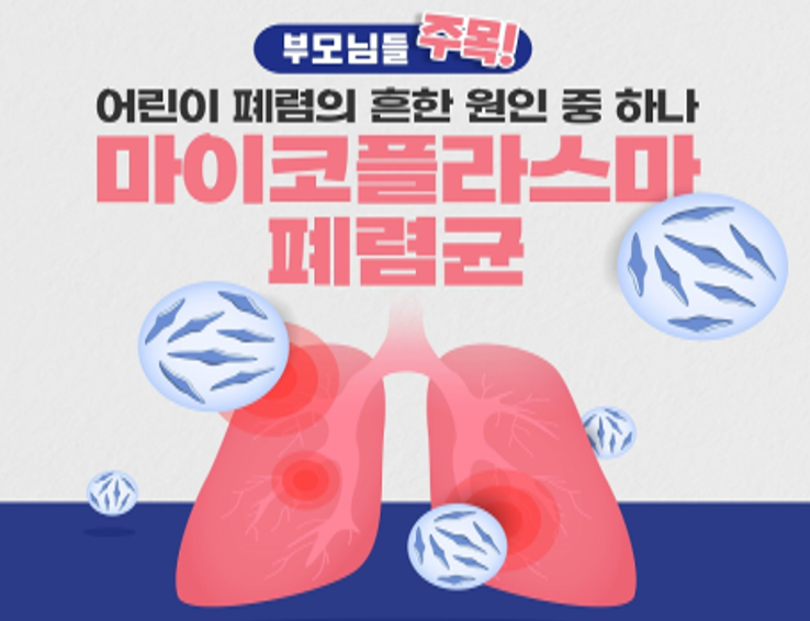  아기 폐렴 마이코플라즈마 폐렴 증상 전염 예방법