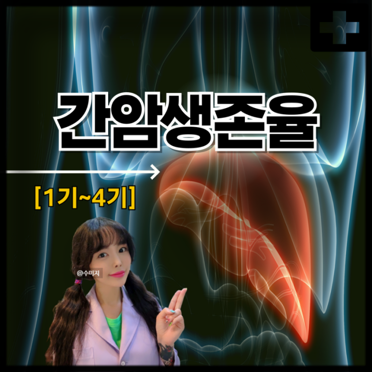  간암 1기 2기 3기 4기 증상 생존율 재발 암치료