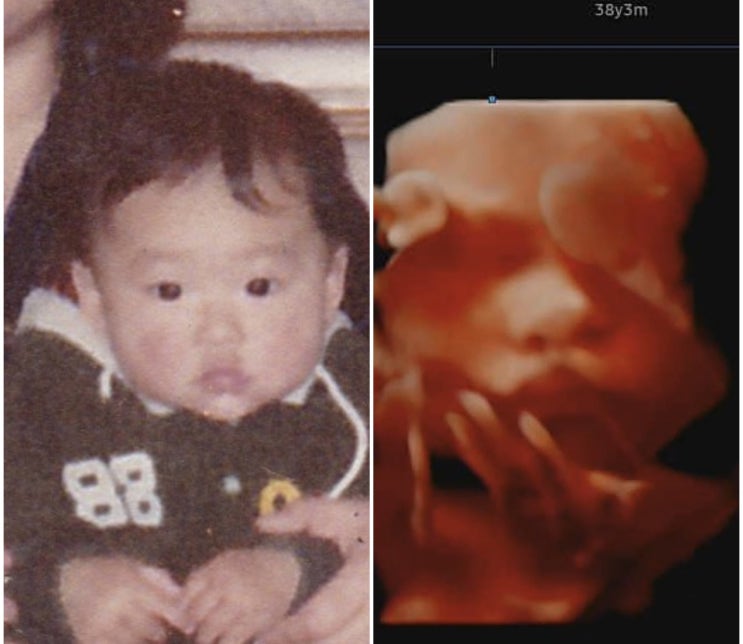  임신 중기~후기까지의 리동이 기록