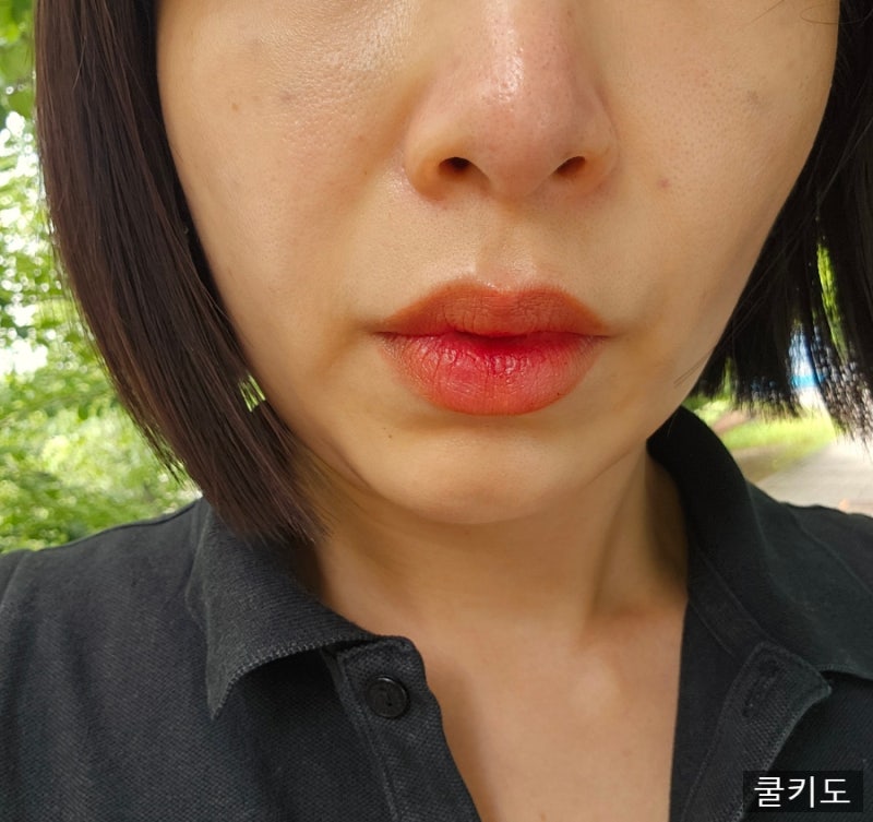 강남역 성형외과 스킨부스터 쥬베룩 후기! 잔주름 개선
