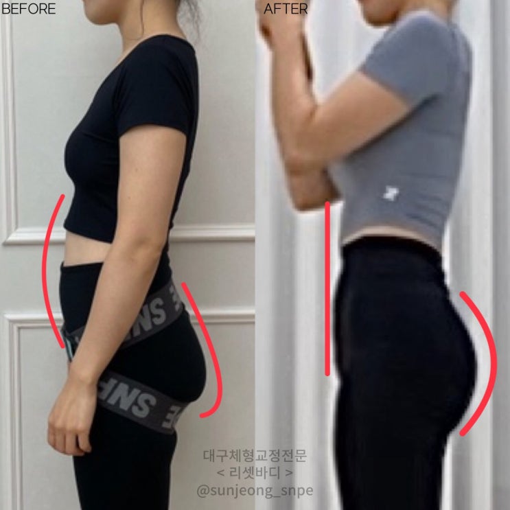  대구 침산동에서 체형교정 센터를 찾고있다면