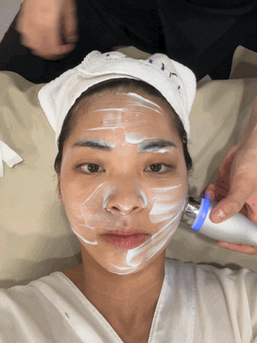  디유에스테틱 여드름 흉터관리 1회차 알라딘필링 후기
