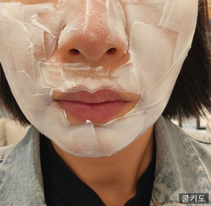 강남역 성형외과 스킨부스터 쥬베룩 후기! 잔주름 개선