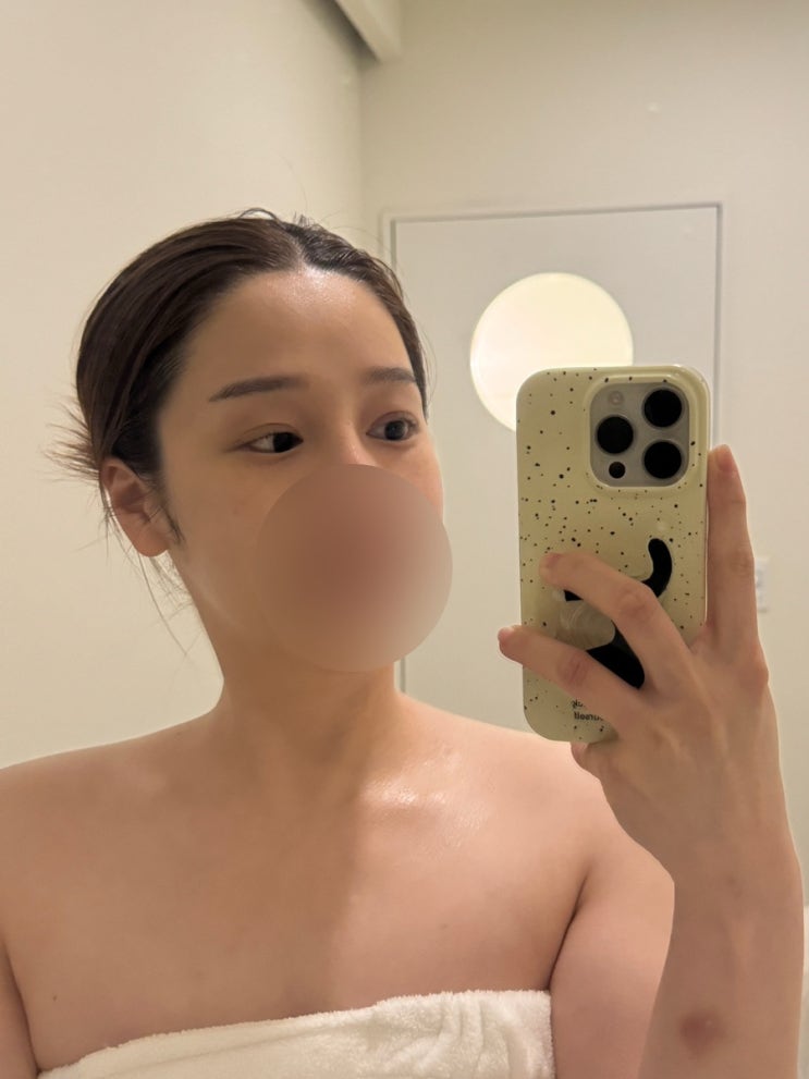  위례 에스테틱 프롬미 위례점 블랙모찌 바이오힐