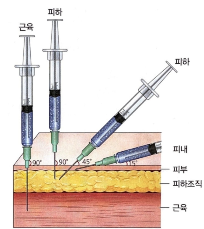 [아트팜] 주사방법 (IM.IV.SC.ID) : 네이버 블로그