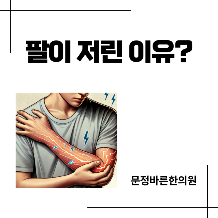 팔저림의 원인을 알아야 합니다 팔저림의 원인을 알아야 합니다