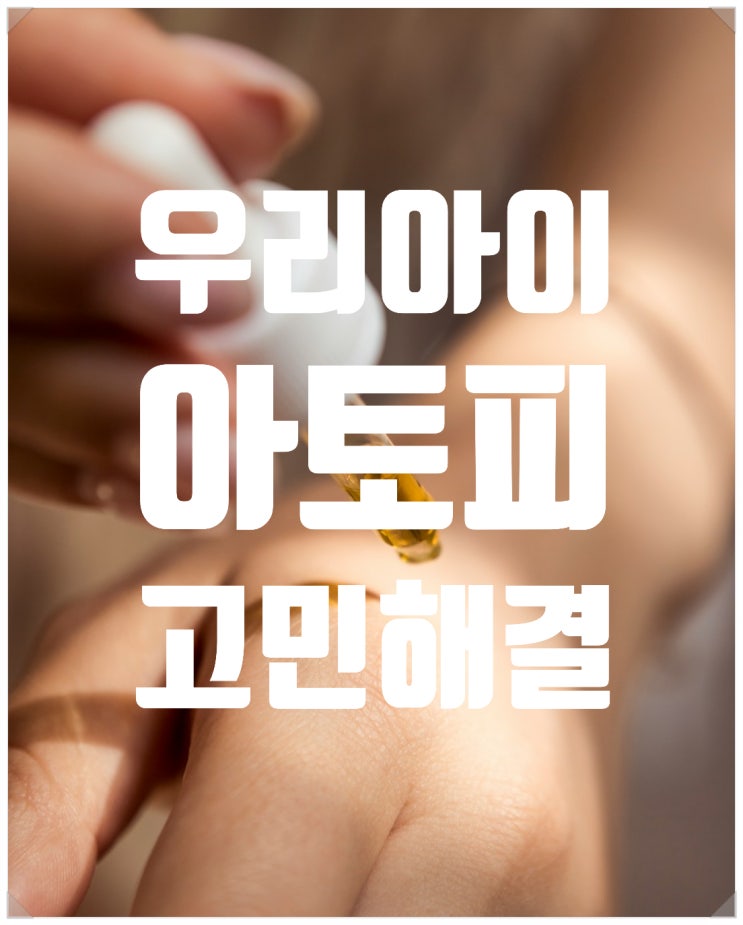  "사랑하는 우리 아이 아토피 관리, 이렇게 해보세요 "