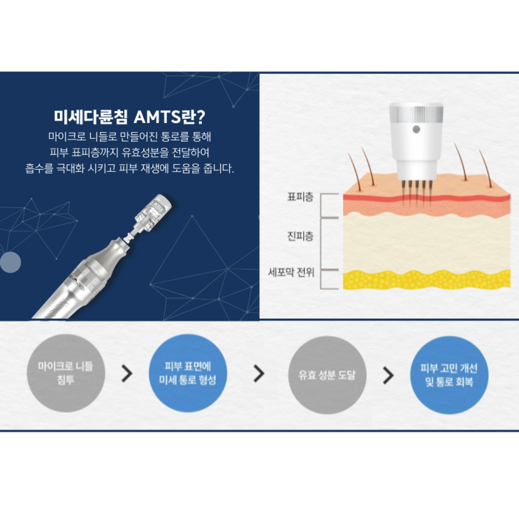  미세다륜침(AMTS) 도입 조민경 경희한의원 피부미용 프로그램 황진이침, 양귀비침: 하남 감일 감이동 한방피부미용성형 한의원
