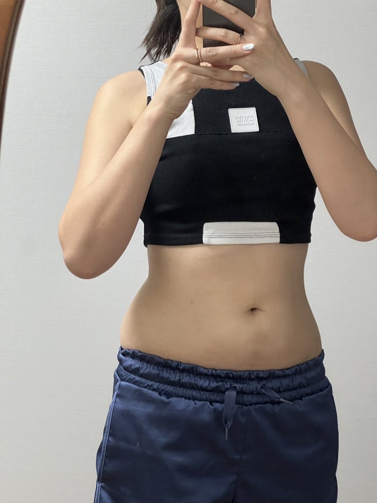  복부&러브핸들 지방추출주사 시술 7주차, 허리라인 봐주세요!