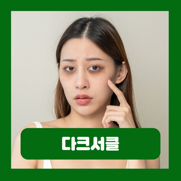  다크서클 생기는 이유 원인별 제거하는 방법 없애는법