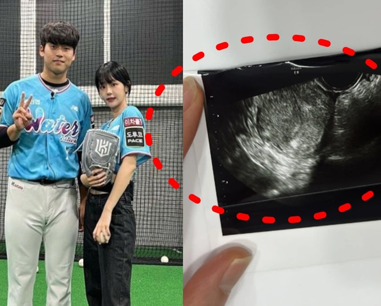 'KT 박영현 여친 양다리 · 임신 · 낙태 논란' 카톡 폭로 중 팬들 가장 경악한 부분 (연애, 쵸단....
