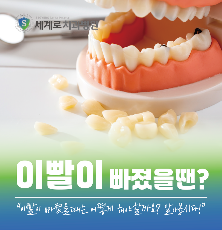  이빨이 빠졌을 때 어떻게 하나요?