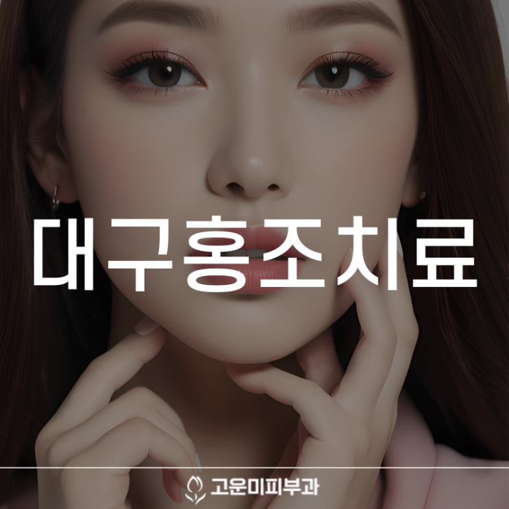  대구홍조 안면홍조 방치하면 주사피부염으로 악화되어 딸기코가 될 수 있습니다