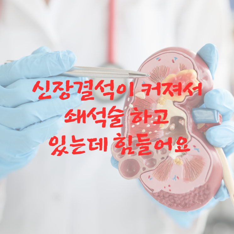  신장결석이 점점 커져서 쇄석술 하고 있는데 힘들어요