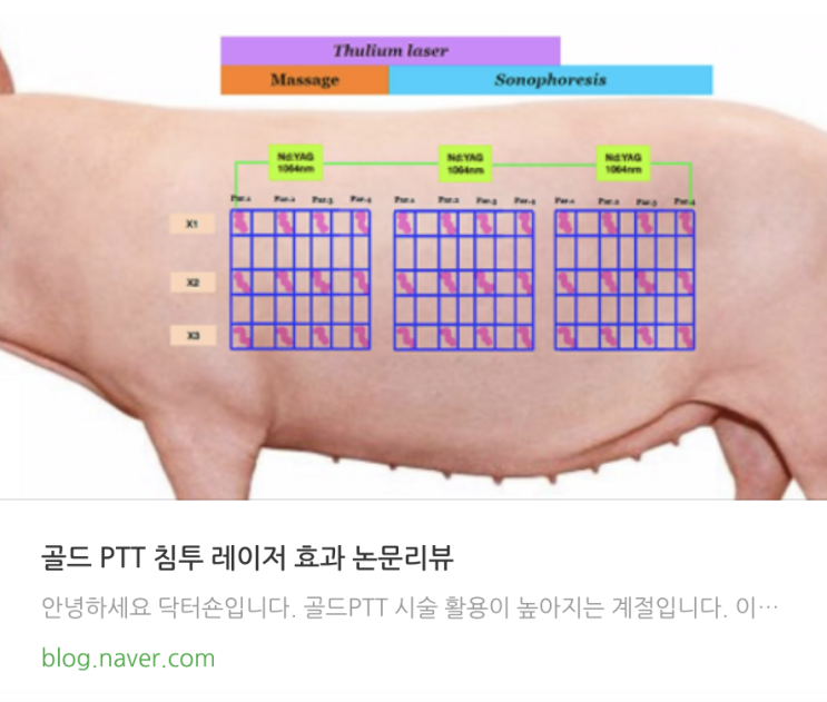  골드PTT 효과 논문 리뷰