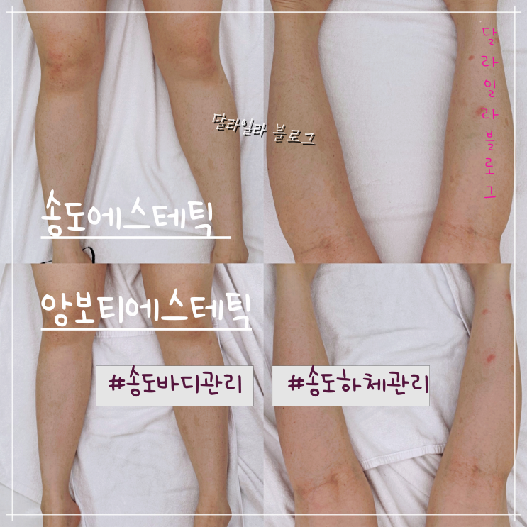  송도에스테틱추천 만족했던 바디관리 하체관리 잘하는곳 앙보티에스테틱
