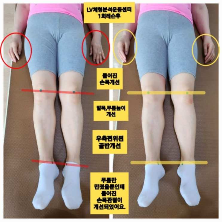  부산 동래 발목통증 발목을 접질리신 회원님 1회레슨 후기
