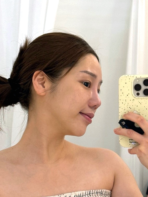  성남 피부관리 라움셀 뷰티랩 퍼스널 B코스