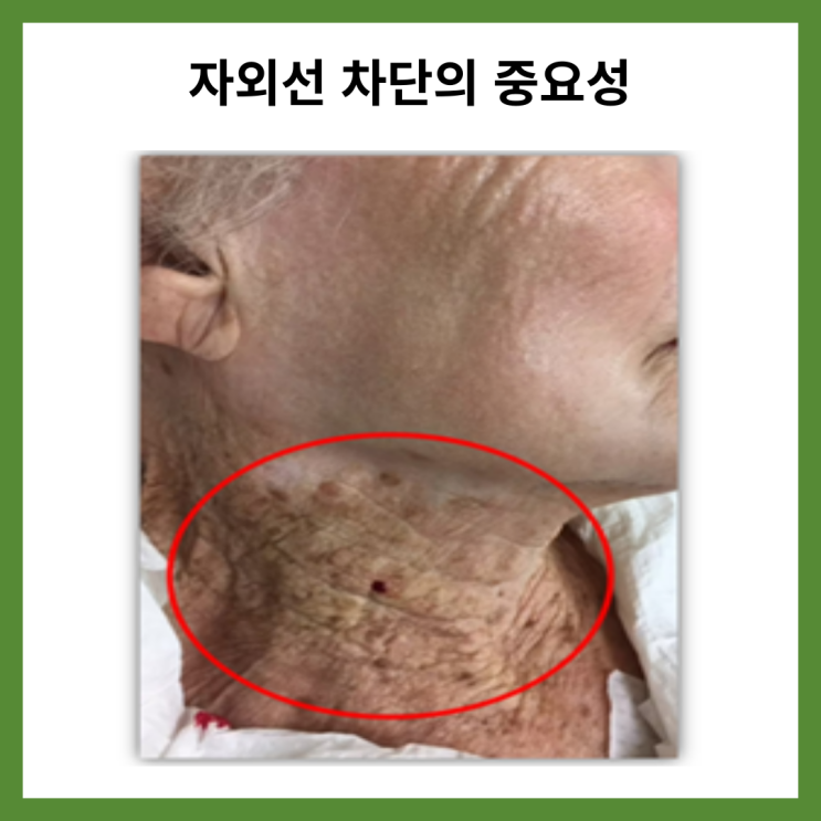  자외선 차단의 중요성과 SPF와 PA 등급