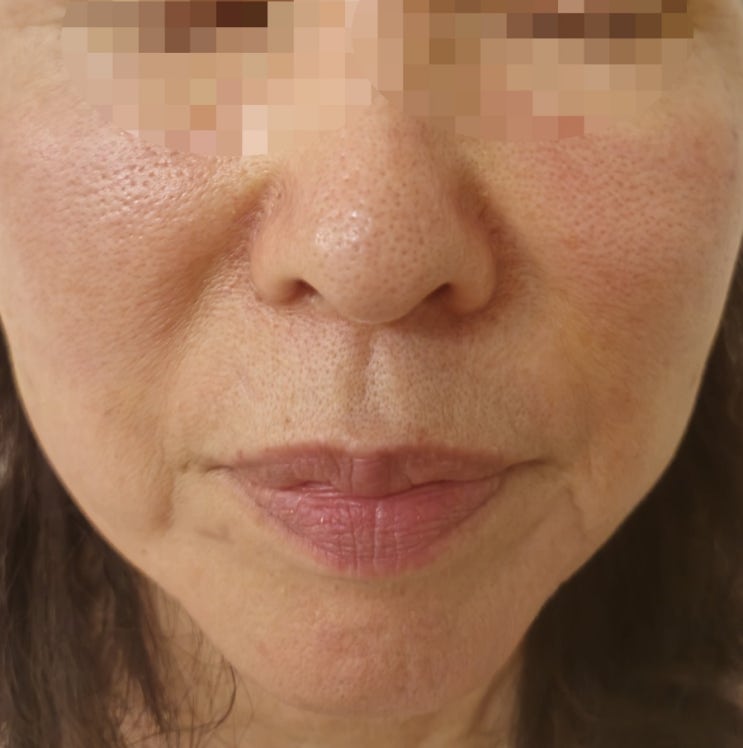  부천에스테틱 잘하는 곳 탄력,수분관리 끝내주네