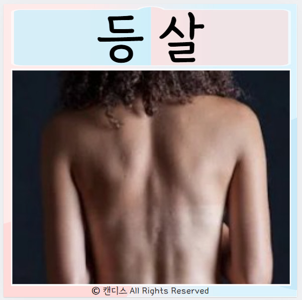  등 살찌는 원인 등 살 빼는 방법