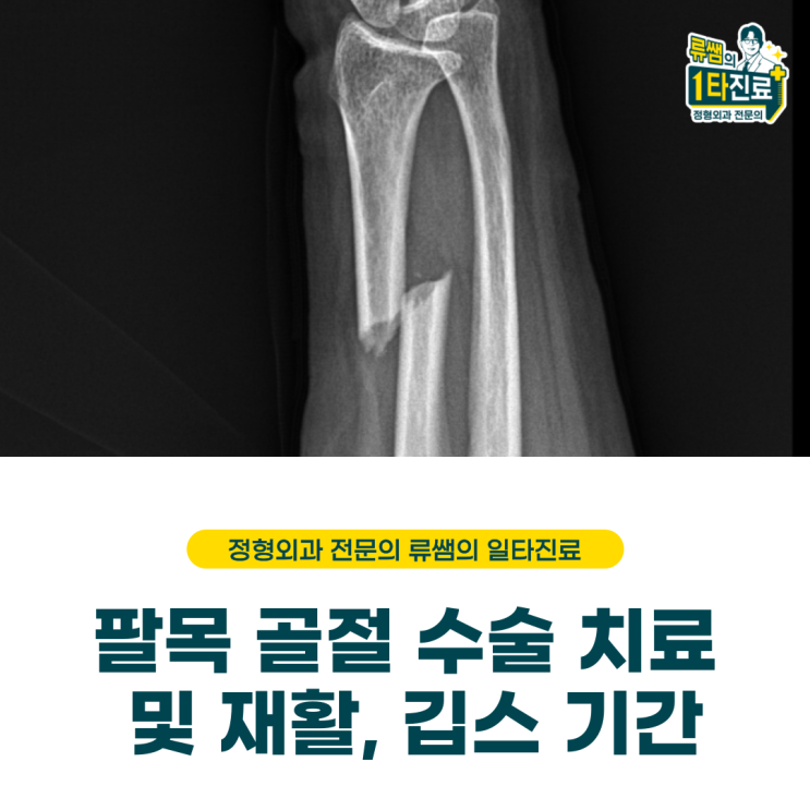  팔목 골절 수술적 치료, 재활 및 깁스 기간 (의사작성)