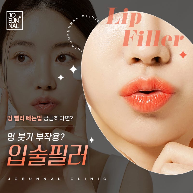 입술필러 멍 붓기 직후 생겼을 때 빼는 법은?