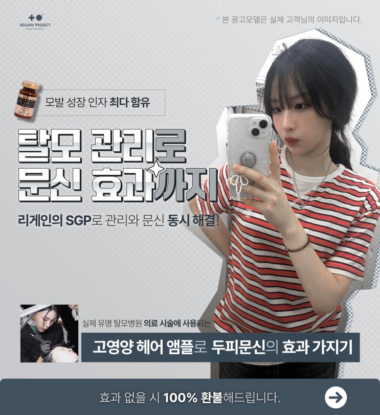수성구두피문신,헤어라인에서 가르마,정수리문신까지 가격 및 탈모관리,부작용 총정리