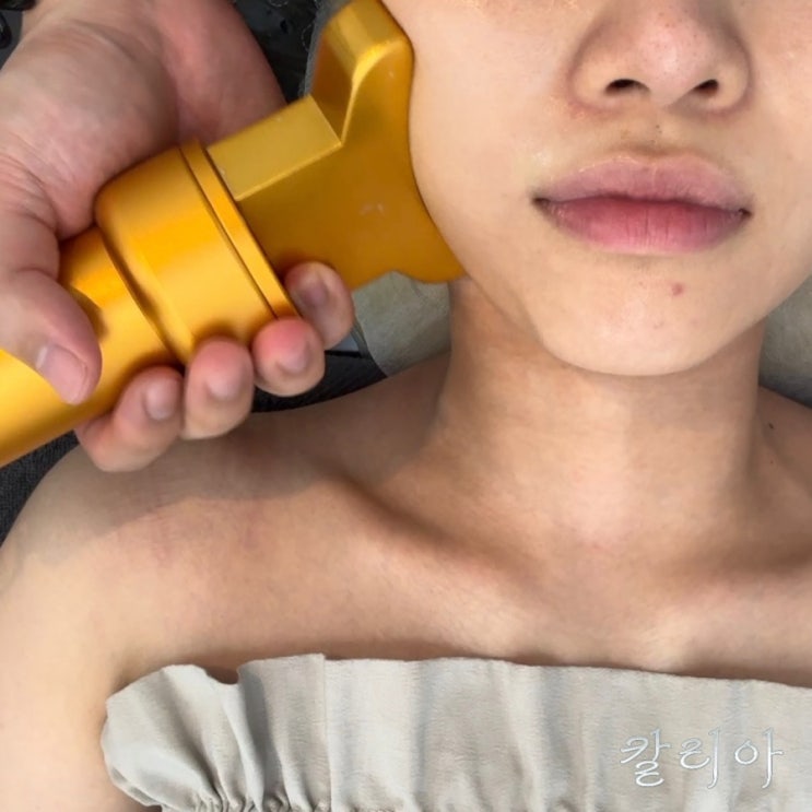  선릉피부관리 칼리아 푸석한 피부 줄기세포 윤곽관리로 얼굴 라인 정리함