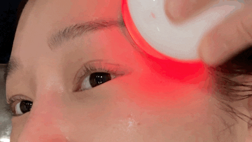  분당피부샵 올가뷰티 푸른 마을 수내점 리프팅 초음파