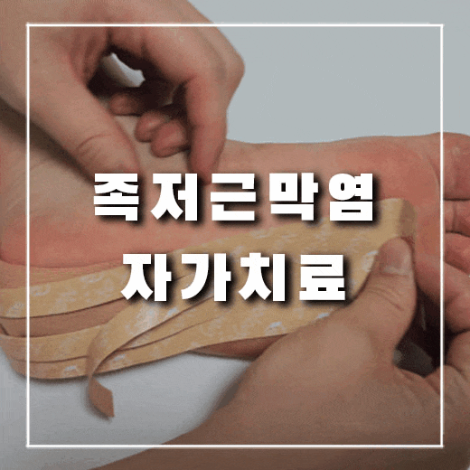  족저근막염 통증에서 한 달 만에 벗어난 방법과 도움 된 신발