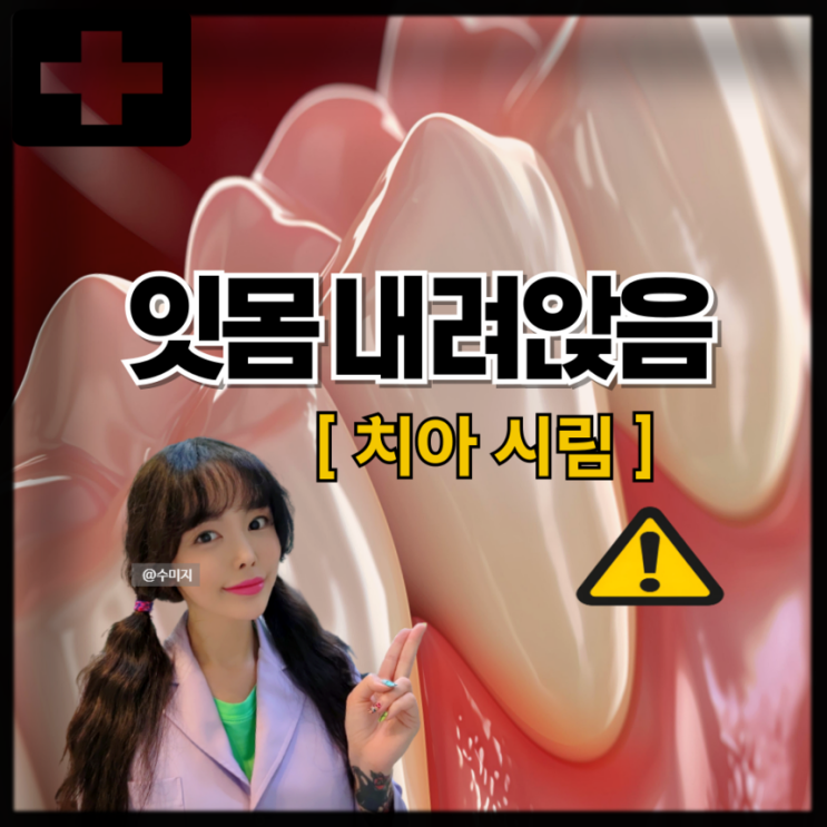  치아시림 원인 치경부마모증 치아 부식 마모 잇몸 내려앉음 이가시릴때 시린이 치료