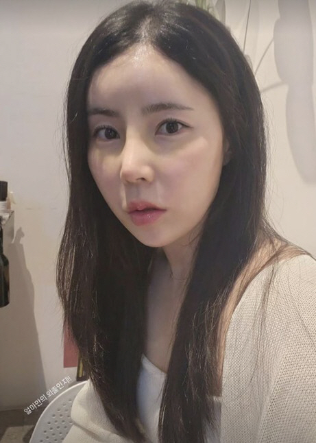 10기 영숙 근황 코 성형 후 높아진 콧대 입툭튀 삭제 행복 10기 영숙 근황 코 성형 후 높아진 콧대 입툭튀 삭제 행복