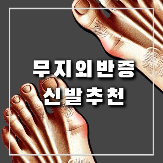  무지외반증 통증을 줄이는 발볼 넓은 운동화