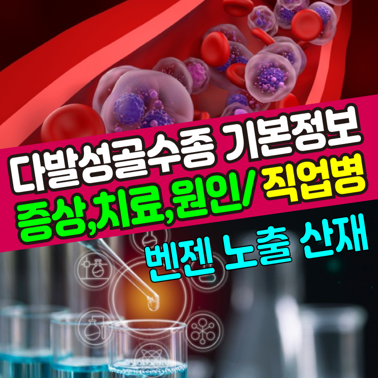  [기본정보] 다발성골수종(증상,치료,원인) 벤젠 노출 직업병 산재