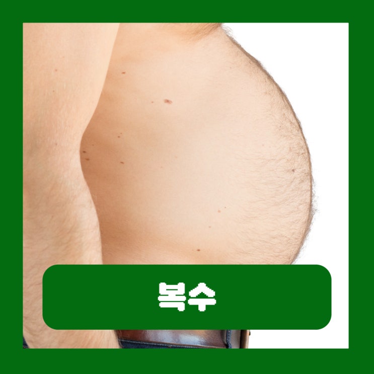  베에 물 찬 느낌 증상 복수 빼는법 간암 원인 알부민 복수천자 치료