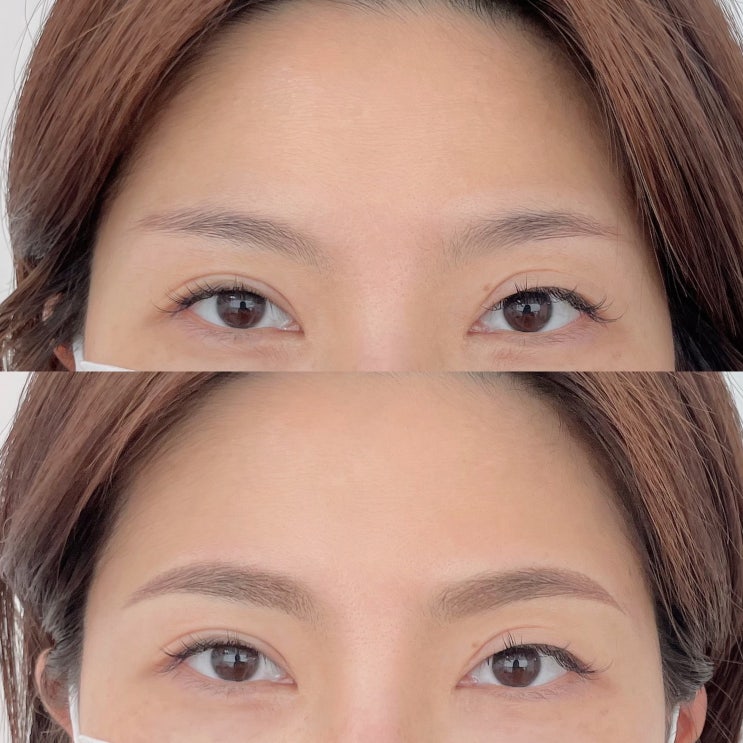  의정부 비대칭교정 수지눈썹문신