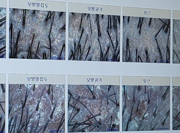  포항 죽도동 두피관리 원한다면 꼼꼼한 케어와 설명에 주차까지 편한 이곳